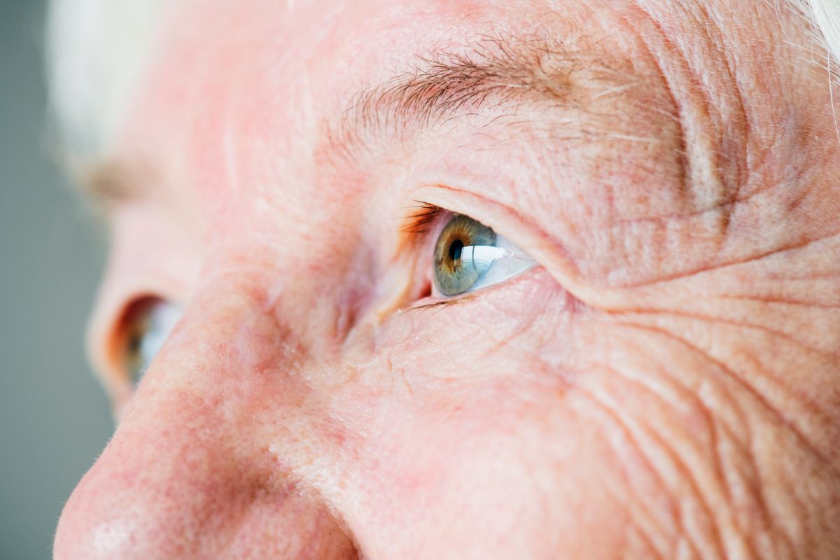Ojo de un paciente de edad avanzada durante valoración para cirugía de cataratas